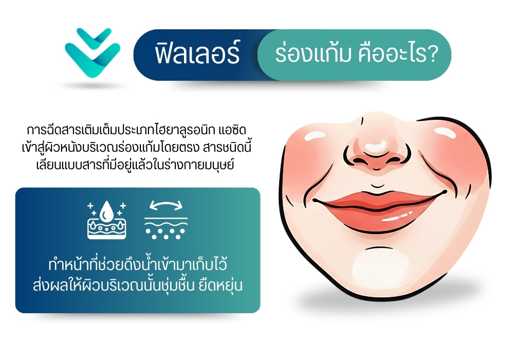 ฟิลเลอร์ร่องแก้ม คืออะไร