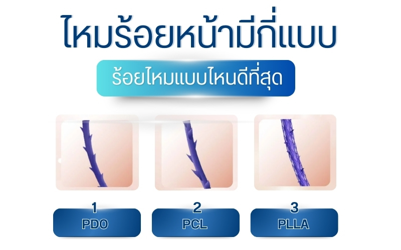 ไหมร้อยหน้ามีกี่แบบ