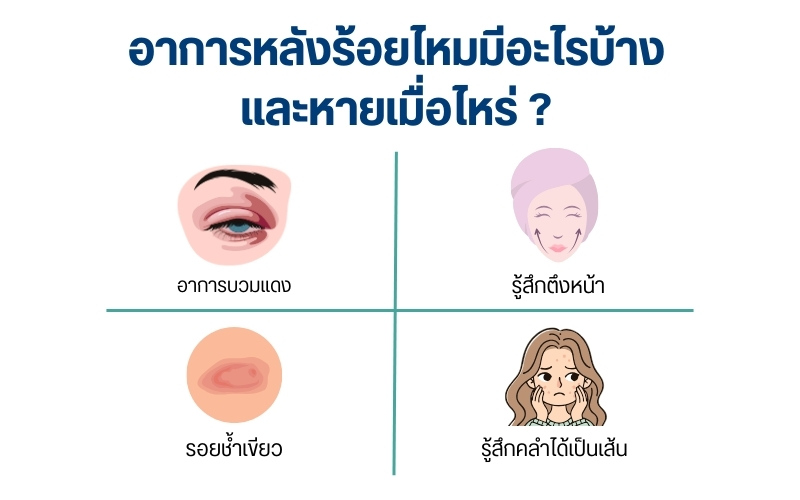 อาการหลังร้อยไหมมีอะไรบ้าง และหายเมื่อไหร่ ?