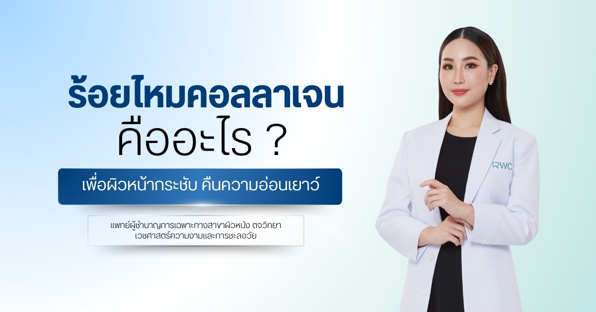 ร้อยไหมคอลลาเจน คืออะไร