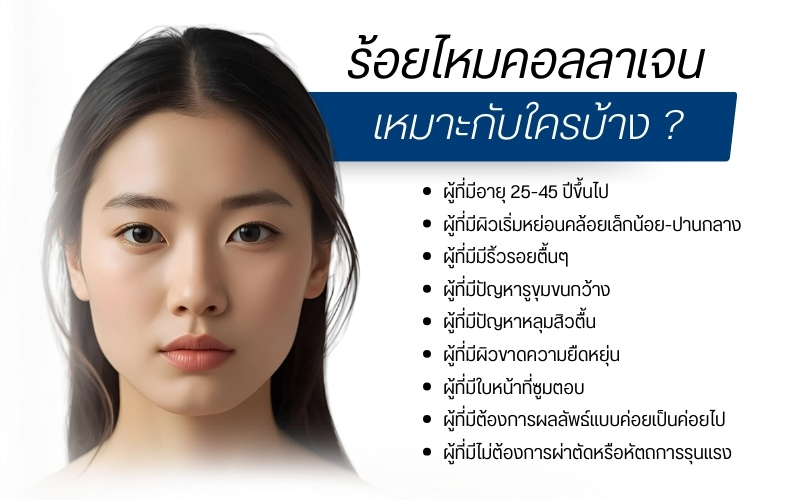 ร้อยไหมคอลลาเจน เหมาะกับใครบ้าง ?