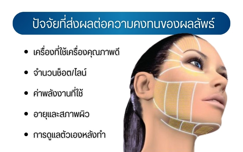 ปัจจัยที่ส่งผลต่อความคงทนของผลลัพธ์