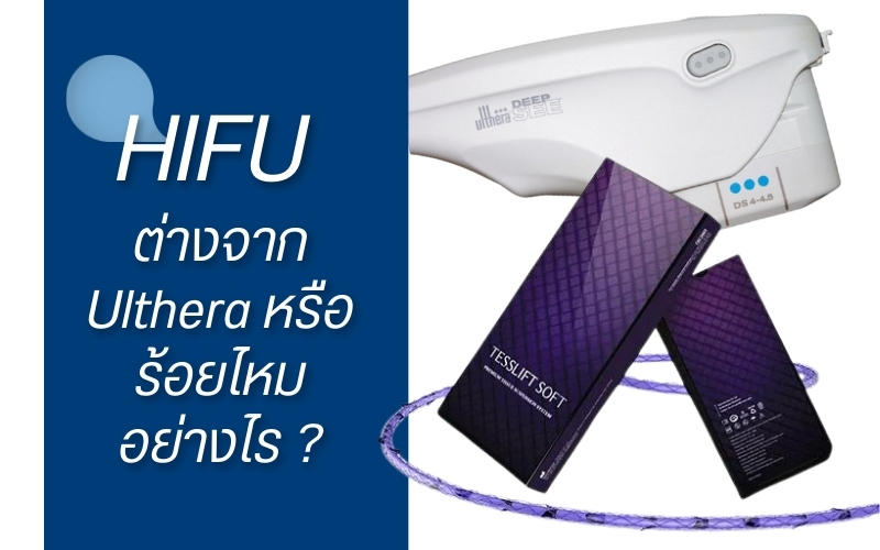 HIFU ต่างจาก Ulthera หรือร้อยไหม อย่างไร ?