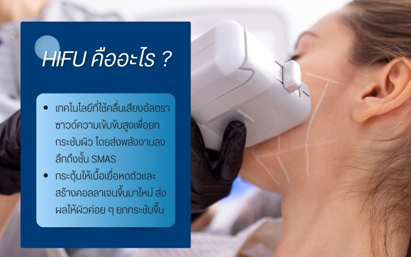 HIFU คืออะไร ?