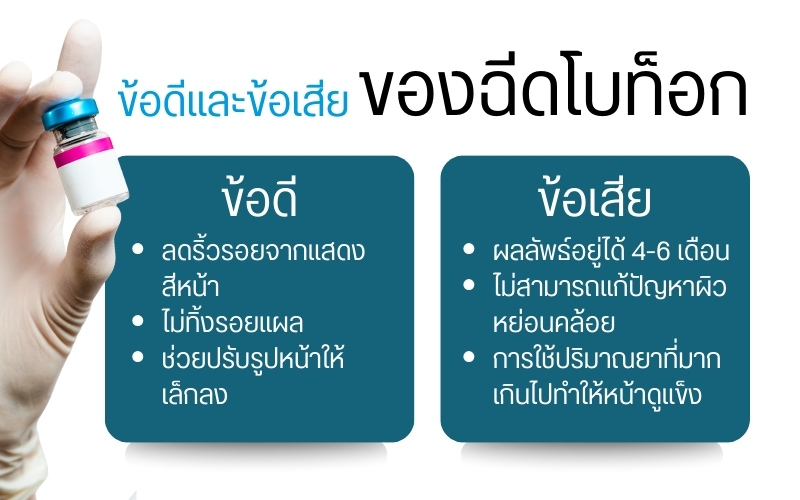 ข้อดีและข้อเสียของการฉีดโบ