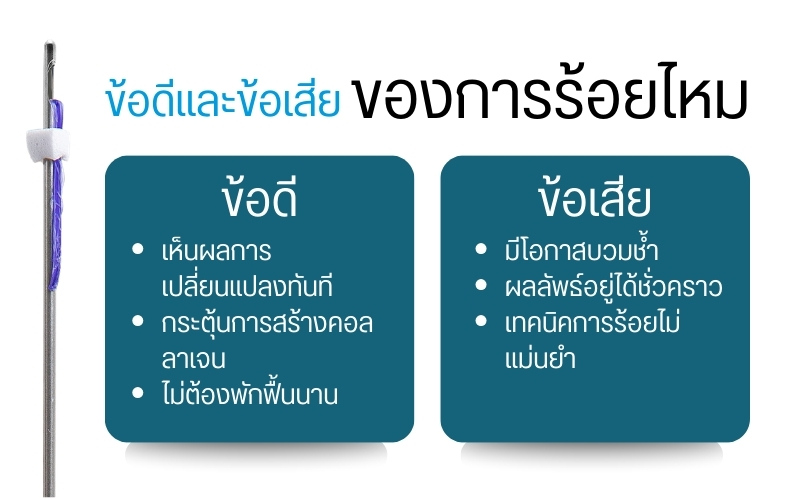 ข้อดีและข้อเสียของการร้อยไหม