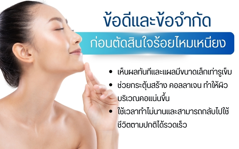 ข้อดีและข้อจำกัดที่ควรทราบก่อนตัดสินใจร้อยไหมเหนียง