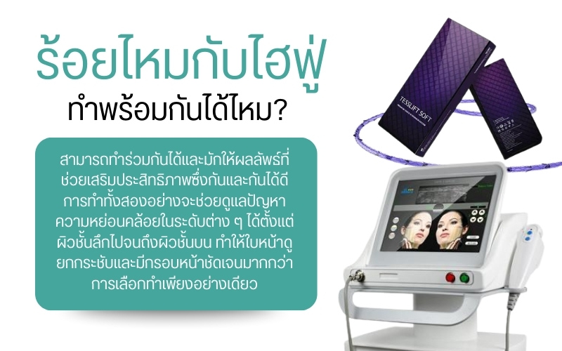 ร้อยไหมกับไฮฟูทำร่วมกันได้ไหม ?