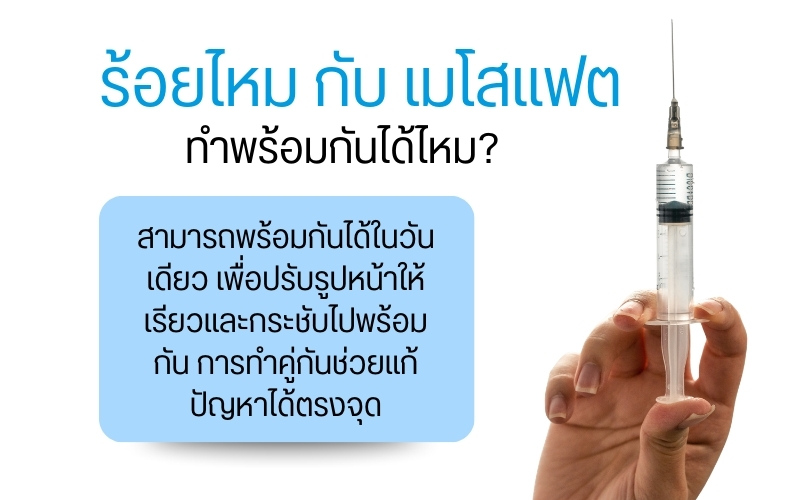 ร้อยไหม กับ เมโสแฟต ทำพร้อมกันได้ไหม