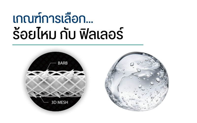 การเลือกทำ ร้อยไหม กับ ฟิลเลอร์