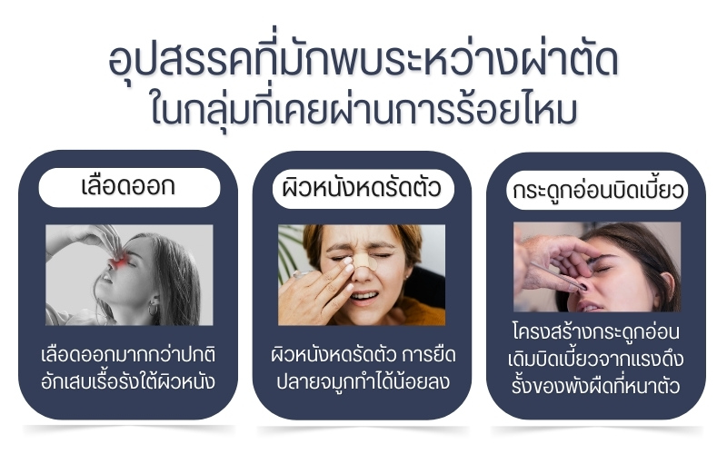 อุปสรรคที่มักพบระหว่างผ่าตัด