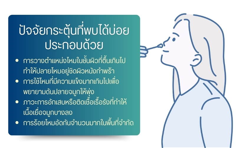 ปัจจัยกระตุ้นที่พบได้บ่อยประกอบด้วย