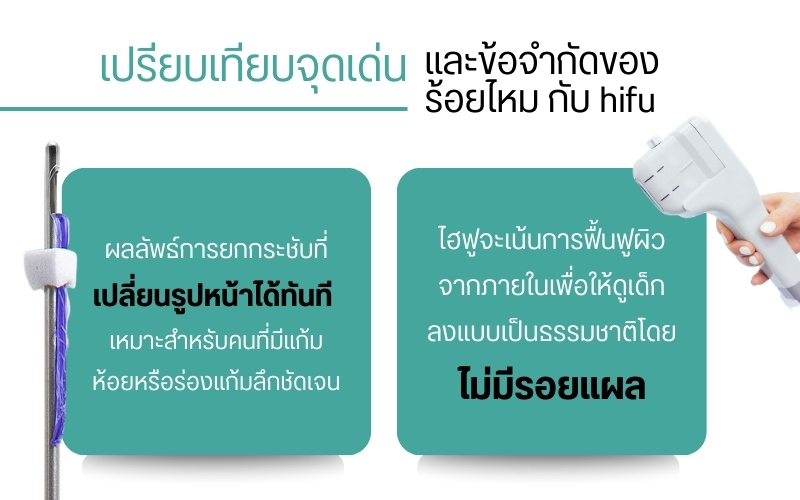 เปรียบเทียบจุดเด่นและข้อจำกัดของร้อยไหม กับ hifu