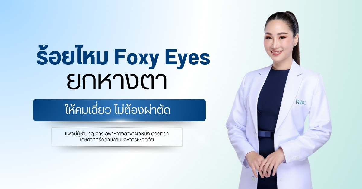 ร้อยไหม Foxy Eyes ยกหางตาให้คมเฉี่ยว ไม่ต้องผ่าตัด