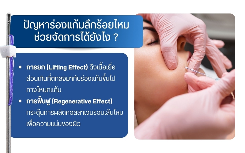 ปัญหาร่องแก้มลึกร้อยไหมช่วยจัดการได้ยังไง ?