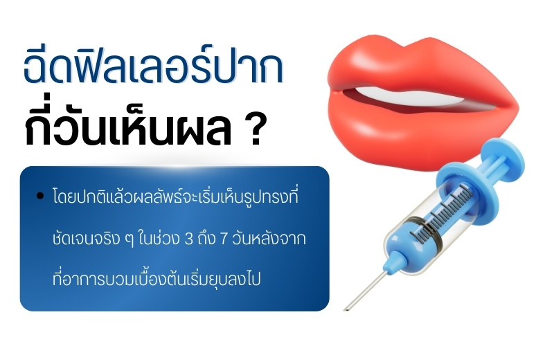 ฉีดฟิลเลอร์ปากกี่วันเห็นผล