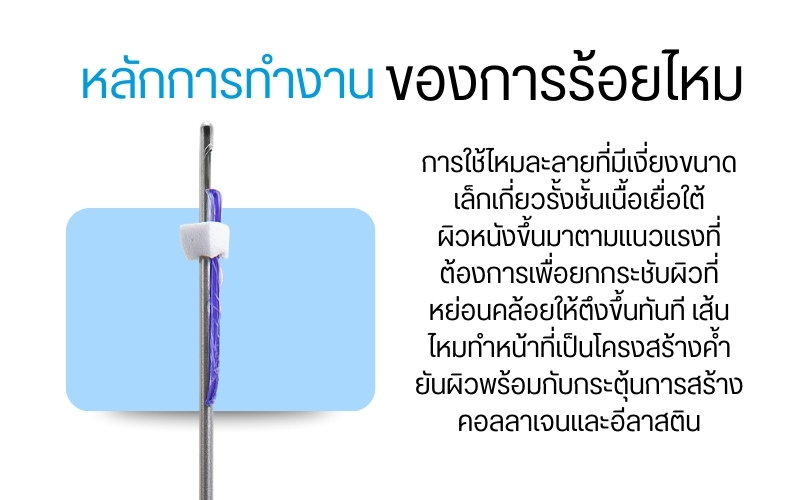 หลักการทำงานของการร้อยไหม