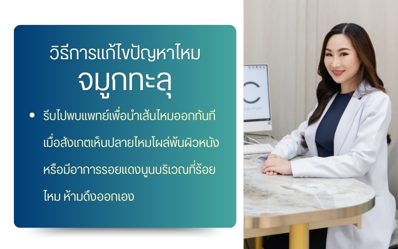 วิธีการแก้ไขปัญหาไหม จมูกทะลุ