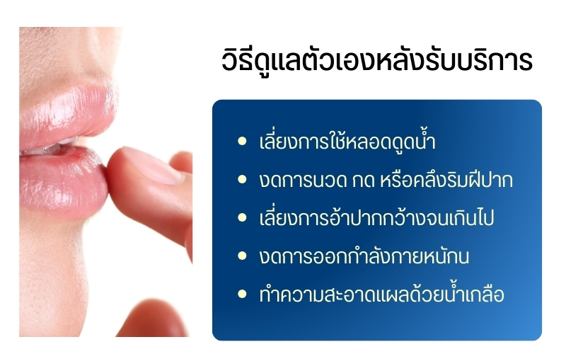 วิธีดูแลตัวเองหลังรับบริการ