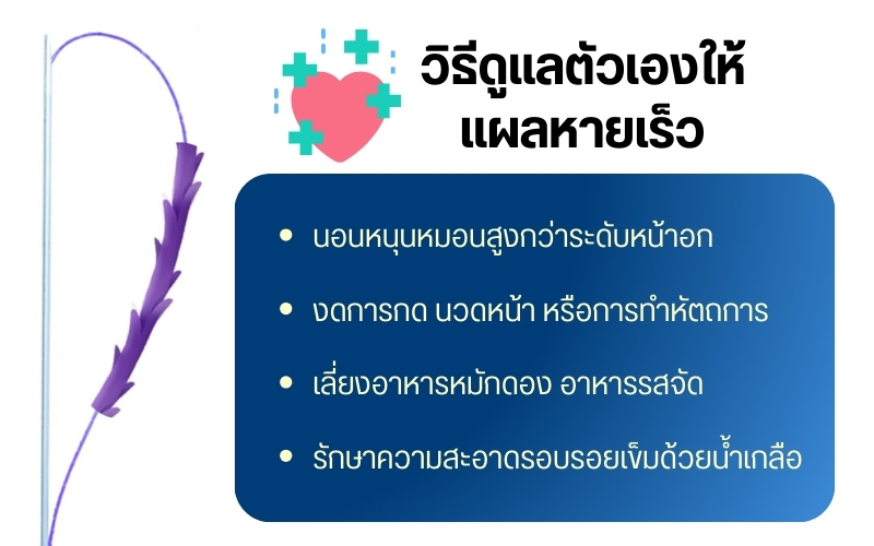 วิธีดูแลตัวเองให้แผลหายเร็ว