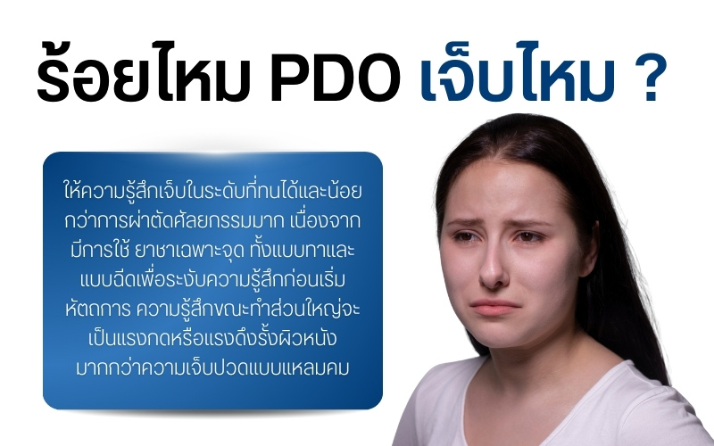 ร้อยไหม pdo เจ็บไหม ?