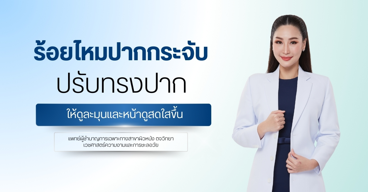 ร้อยไหมปากกระจับ ปรับทรงปากให้ดูละมุนและหน้าดูสดใสขึ้น