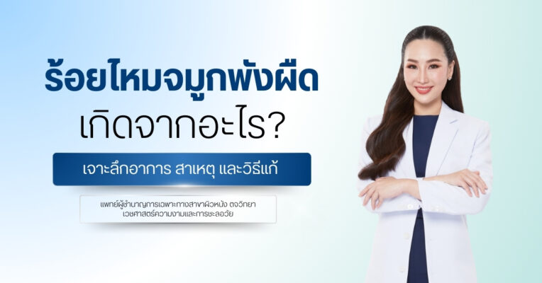 ร้อยไหมจมูกพังผืด เกิดจากอะไร?