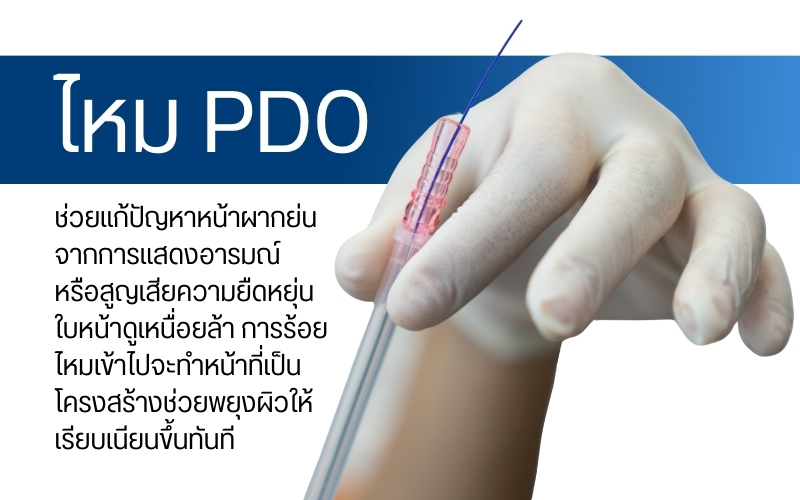 การร้อยไหมหน้าผาก