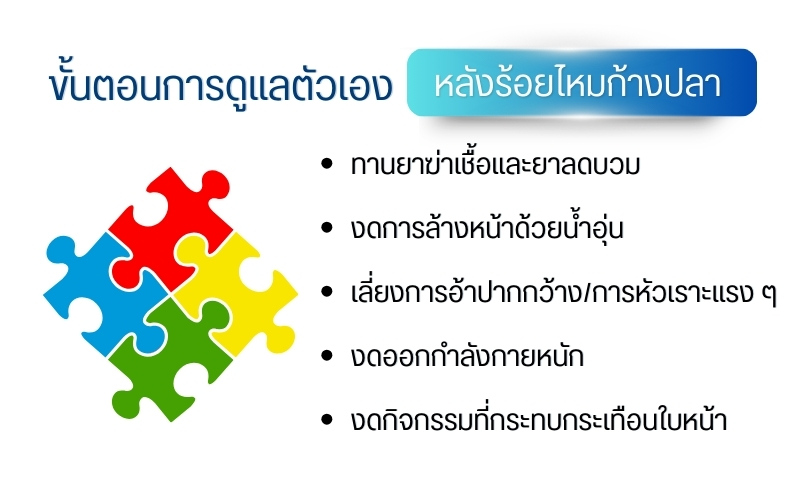 ขั้นตอนการดูแลตัวเองหลังร้อยไหมก้างปลา