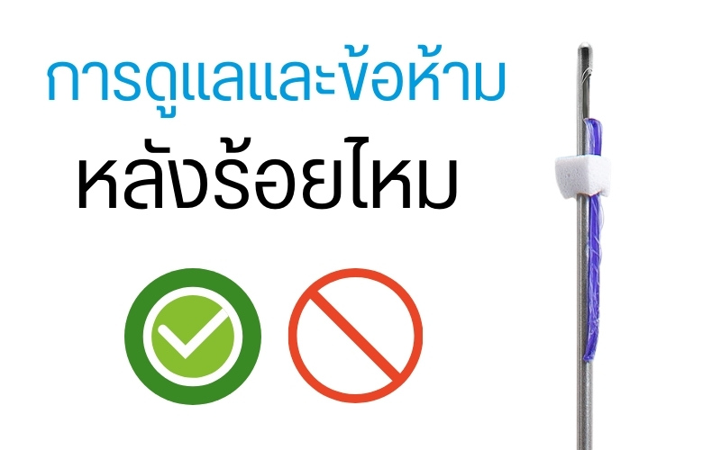 การดูแลและข้อห้ามหลังร้อยไหม