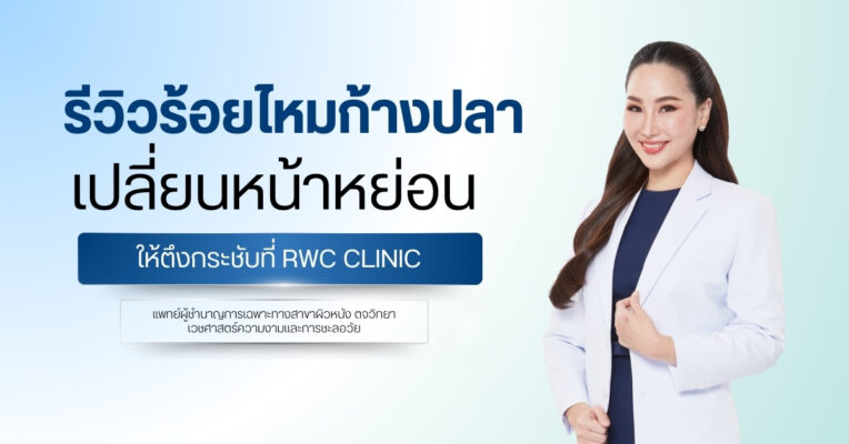 รีวิวร้อยไหมก้างปลา