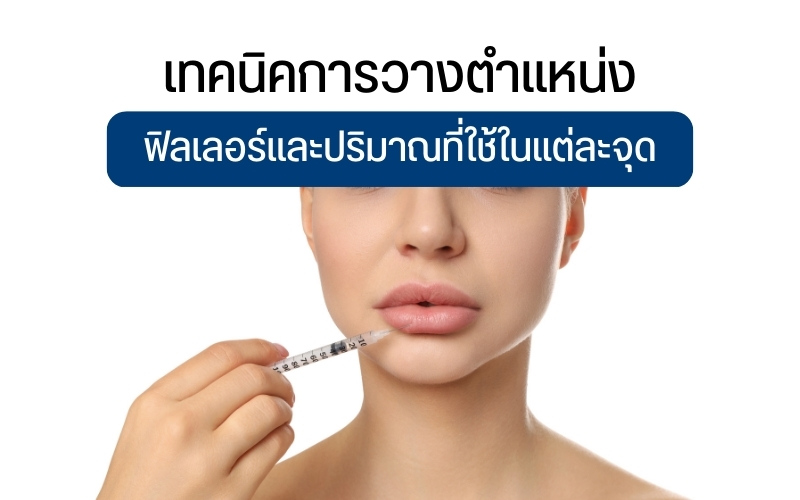 เทคนิคการวางตำแหน่งฟิลเลอร์และปริมาณที่ใช้ในแต่ละจุด