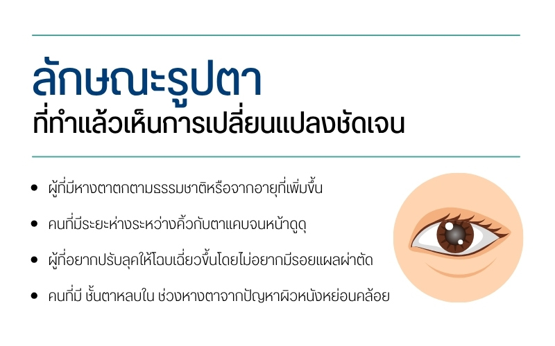 ลักษณะรูปตาที่ทำแล้วเห็นการเปลี่ยนแปลงชัดเจน
