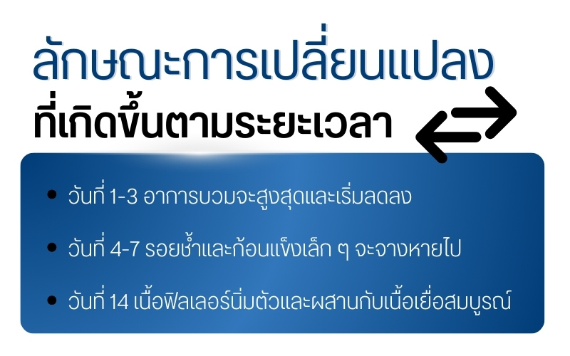 ลักษณะการเปลี่ยนแปลงที่เกิดขึ้นตามระยะเวลา