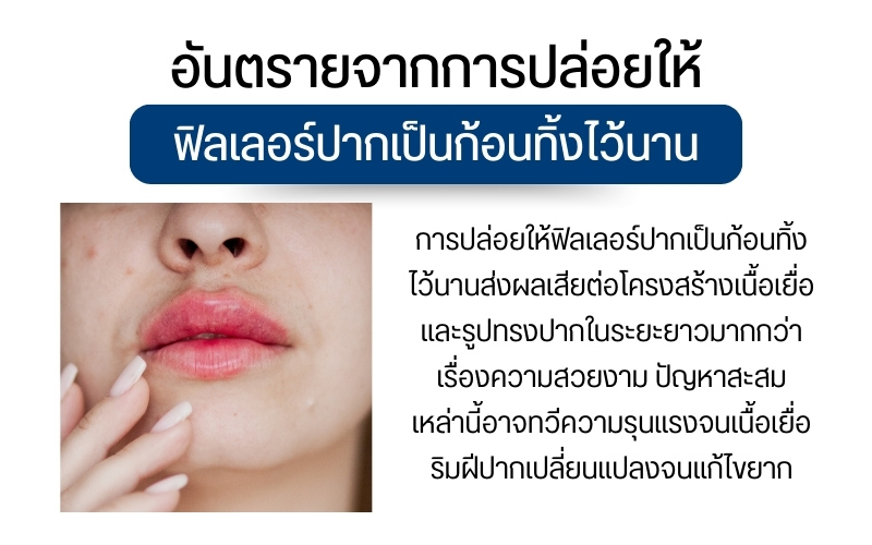 อันตรายจากการปล่อยให้ฟิลเลอร์ปากเป็นก้อนทิ้งไว้นาน