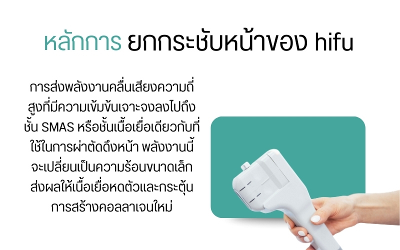 หลักการยกกระชับหน้าของ hifu