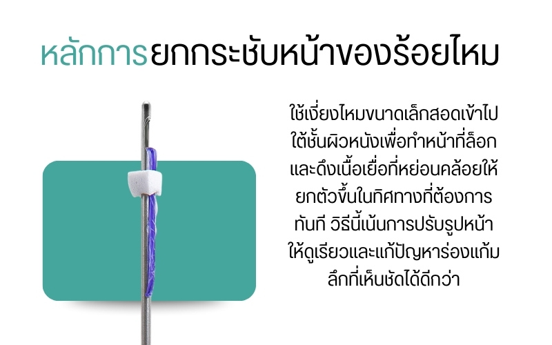 หลักการยกกระชับหน้าของร้อยไหม