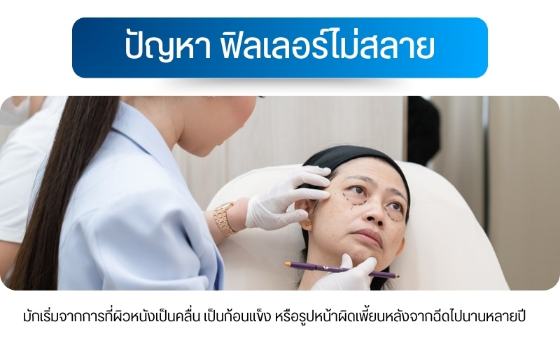 ปัญหา ฟิลเลอร์ไม่สลาย