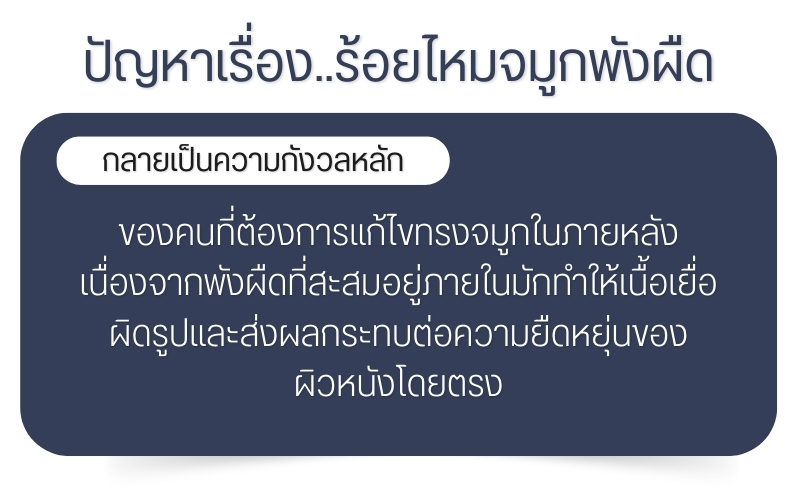 ร้อยไหมจมูกพังผืด