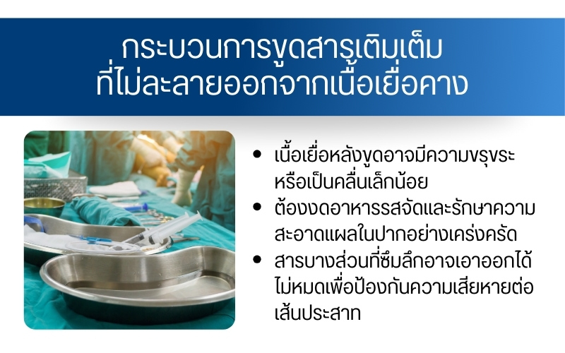 กระบวนการขูดสารเติมเต็มที่ไม่ละลายออกจากเนื้อเยื่อคาง