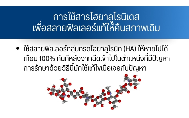 การใช้สารไฮยาลูโรนิเดสเพื่อสลายฟิลเลอร์แท้ให้คืนสภาพเดิม