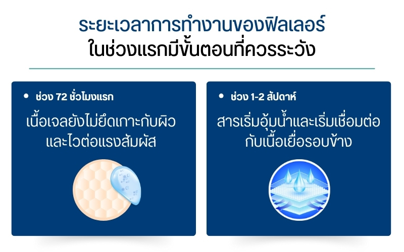 ระยะเวลาการทำงานของฟิลเลอร์ในช่วงแรกมีขั้นตอนที่ควรระวัง
