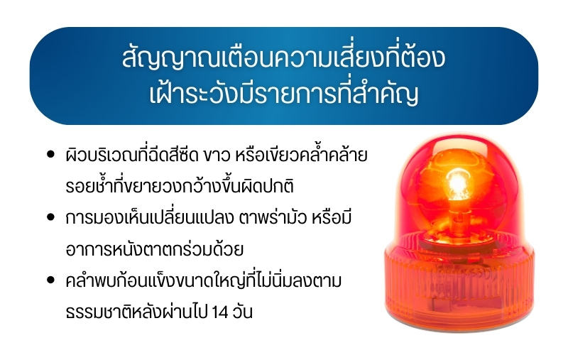สัญญาณเตือนความเสี่ยงที่ต้องเฝ้าระวังมีรายการที่สำคัญ