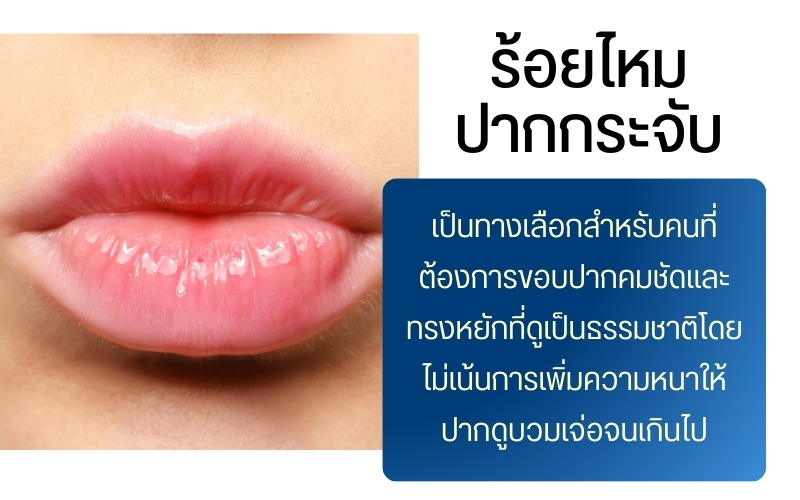 ร้อยไหมปากกระจับ