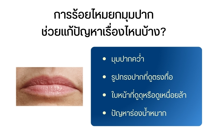 การร้อยไหมยกมุมปากช่วยแก้ปัญหาเรื่องไหนบ้าง?