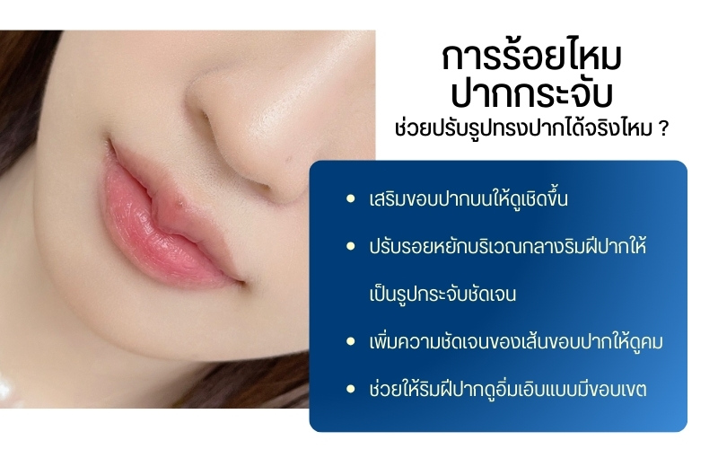 การร้อยไหมปากกระจับช่วยปรับรูปทรงปากได้จริงไหม ?