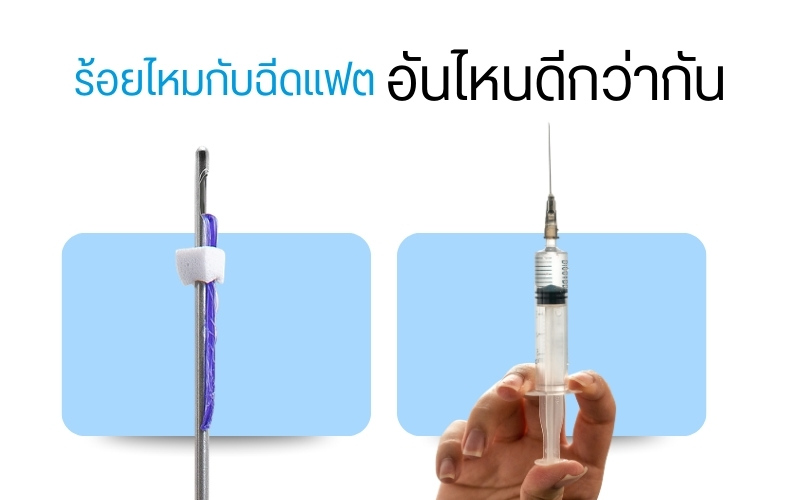ร้อยไหม กับ ฉีดแฟต