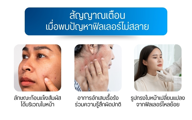 สัญญาณเตือนเมื่อพบปัญหาฟิลเลอร์ไม่สลาย