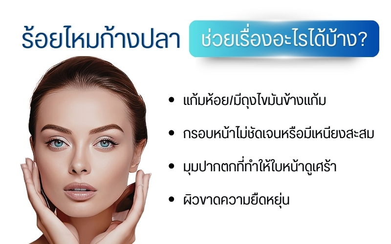 ร้อยไหมก้างปลา ช่วยเรื่องอะไรได้บ้าง?