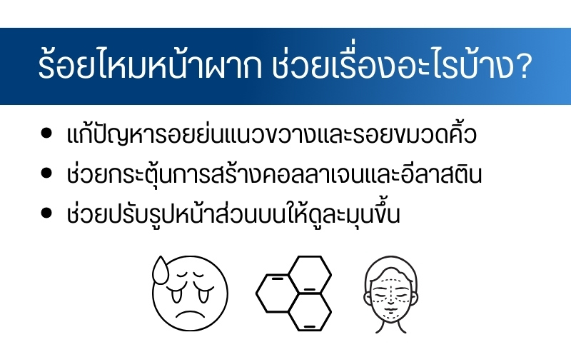 ร้อยไหมหน้าผาก ช่วยเรื่องอะไรบ้าง?